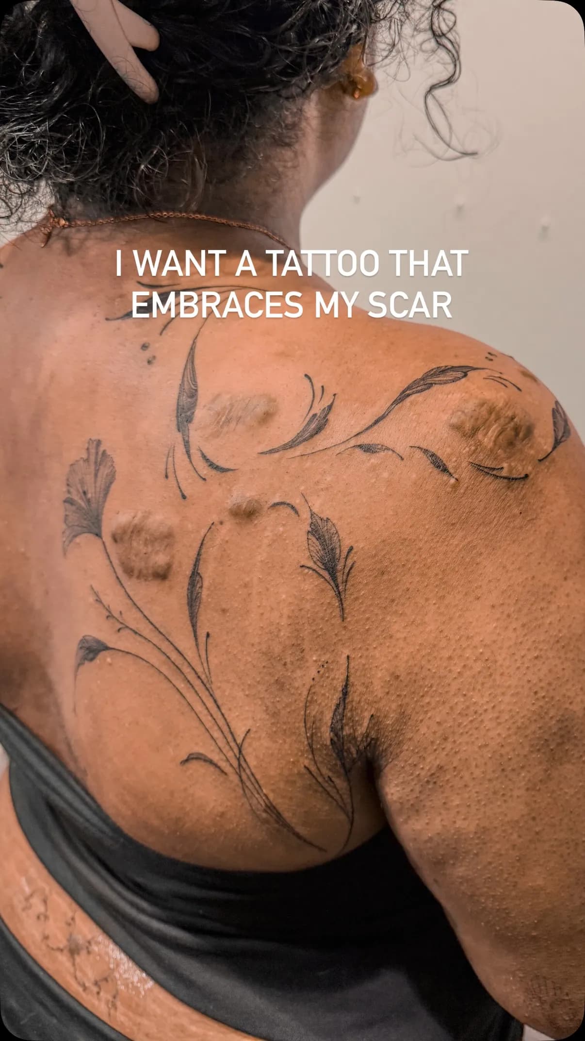 Soft botanical leaves and stems drawn around keloid scarring across the upper back and shoulder, designed to live alongside the scar rather than cover it.